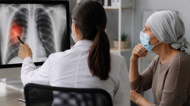 Câncer de pulmão ainda mata mais de 30 mil brasileiros por ano; diagnóstico precoce continua sendo o maior desafio