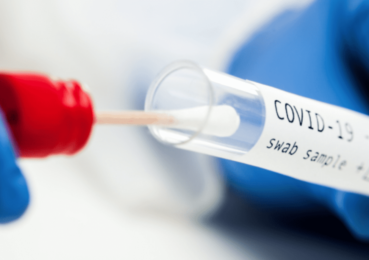 Reinfecção da covid-19 pode ocorrer em apenas 20 dias – Centro de Vitória